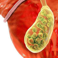 لاپاراسکوپی و بیماری های گوارشی دکتر فرامرز همایونی