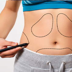 جراحی های زیبایی شکم و صورت دکتر فرامرز همایونی